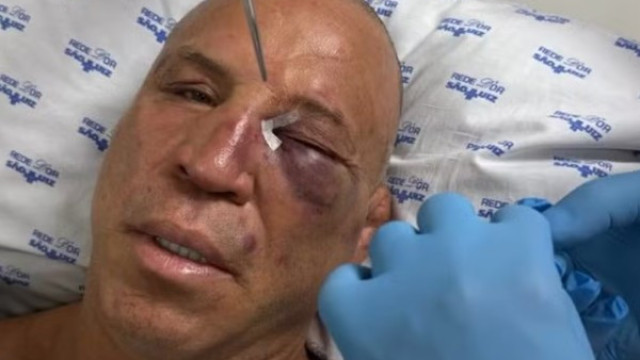 Wanderlei reclama de dores de cabeça e diz: 'magoado por dentro e por fora'